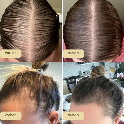 Natürliches Rosmarin-Wachstumsserum + Gratis Wellness-Set