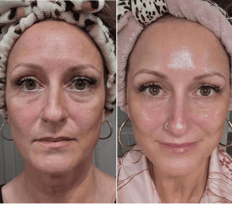 Anti-Age & Intensiver Glow Tagesbalm