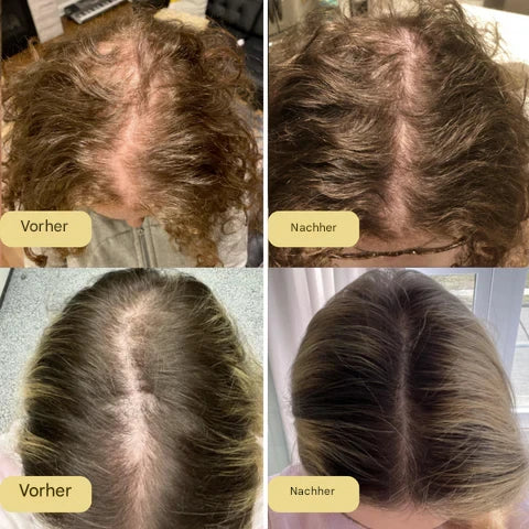 Natürliches Rosmarin-Wachstumsserum + Gratis Wellness-Set