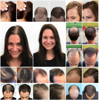 Natürliches Rosmarin-Wachstumsserum + Gratis Wellness-Set
